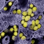Disease detectives track an invisible virus Disease detectives track an invisible virus