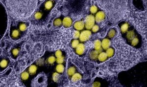 Disease detectives track an invisible virus