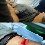 Korban Penganiayaan di Desa Durin Simbelang Kecewa dengan Kinerja Polsek Pancur Batu