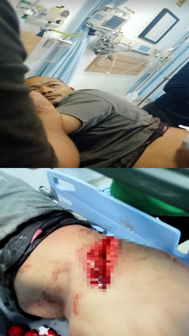 Korban Penganiayaan di Desa Durin Simbelang Kecewa dengan Kinerja Polsek Pancur Batu