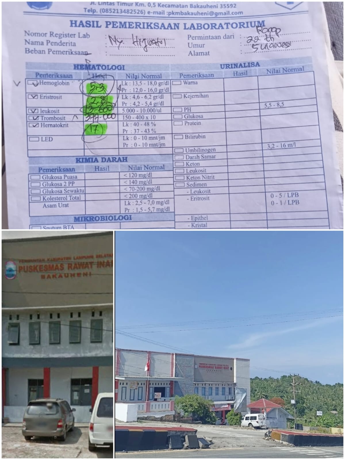 Kasus Dugaan Malpraktik di Lampung Selatan, Persalinan Berujung Operasi
